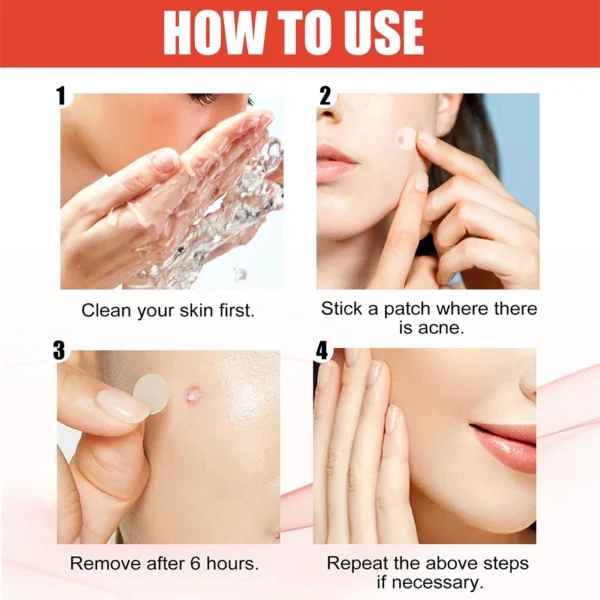 240Pcs New High-end Pimple Patch Acne Patches Heart/Star Shape Acne Dots Patches Moisturizes for Covering Zits and Blemishes - Image 3